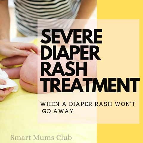 Severe Diaper Rash Remedy - Identifying Causes - Smart Mums Club