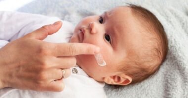 how to treat baby eczema